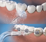 LIMPIADOR IRRIGADOR DENTAL PRO + ENVIO GRATIS