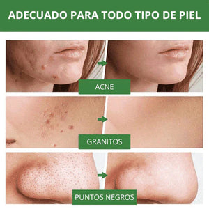 MASCARILLA DETOX DE TE VERDE ANTI ACNE 💚 + ENVIO GRATIS!