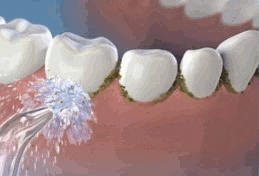 LIMPIADOR IRRIGADOR DENTAL PRO + ENVIO GRATIS