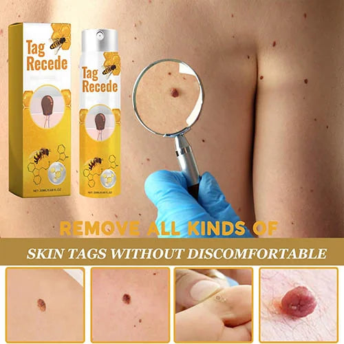 ELIMINADOR DE VERRUGAS + ENVÍO GRATIS🐝