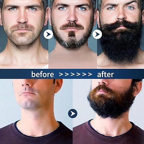 APOLO ESTIMULANTE BARBA VIP - Sérum para Crecimiento de Barba