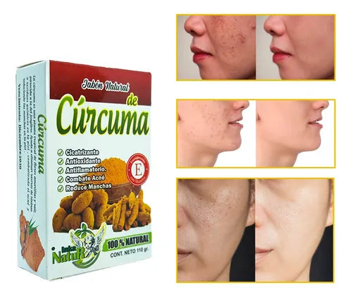 CurcuSkin – Jabón iluminador de cúrcuma (3PACK)